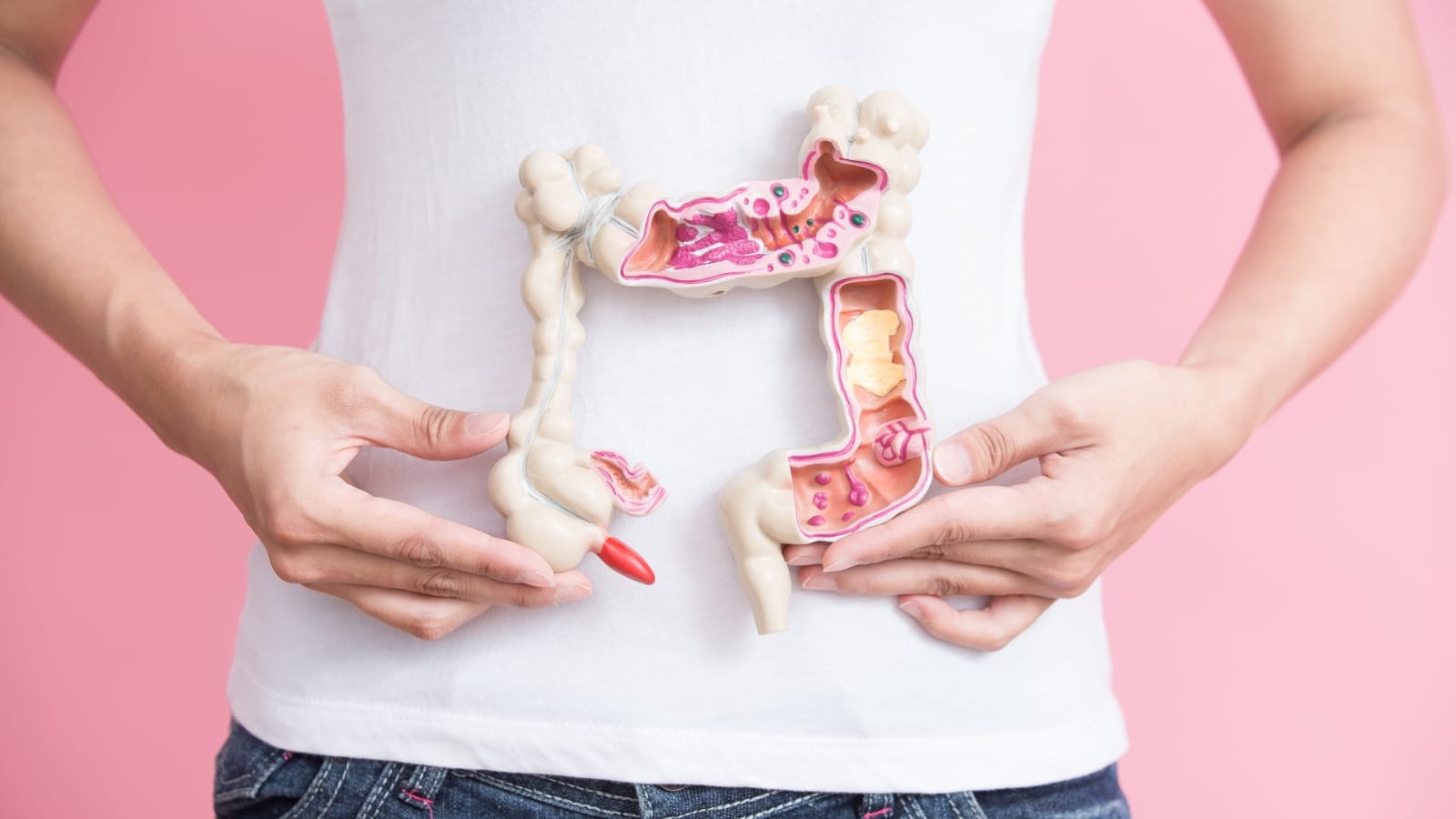 Colorectal cancer graphic. 