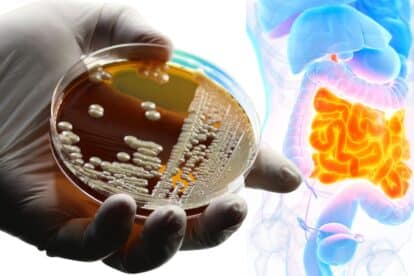 close up of yeast and intestines graphic