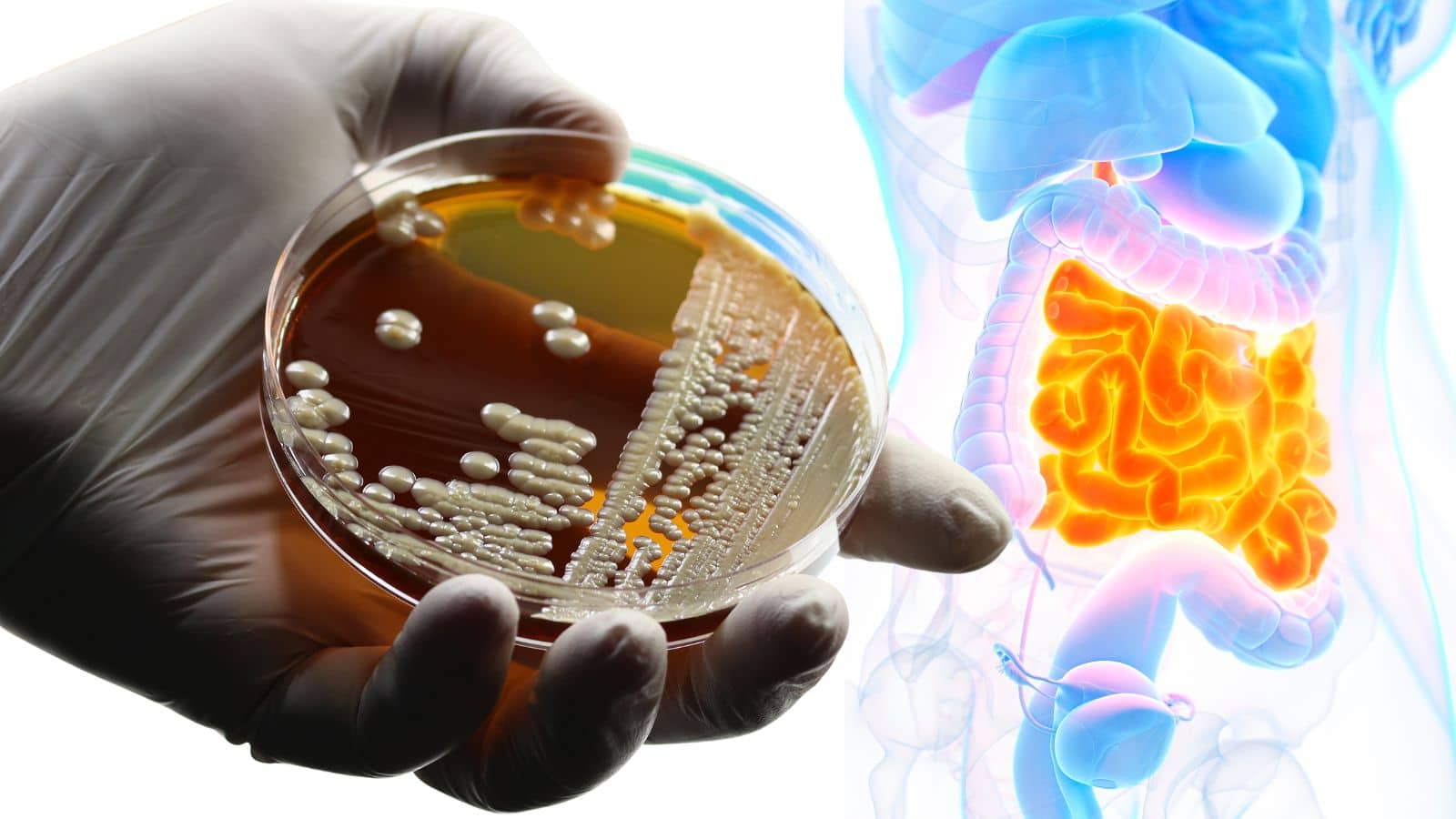 close up of yeast and intestines graphic